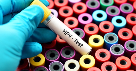 Papilloma Virus Umano (HPV): un nuovo Pap-test negli ambulatori LILT